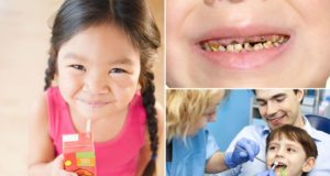 Children in England missing school due to poor teeth